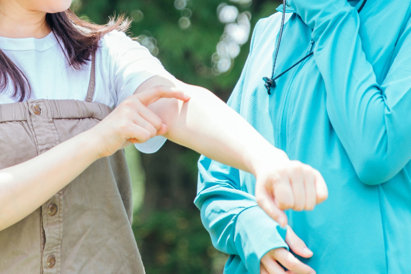 虫刺され